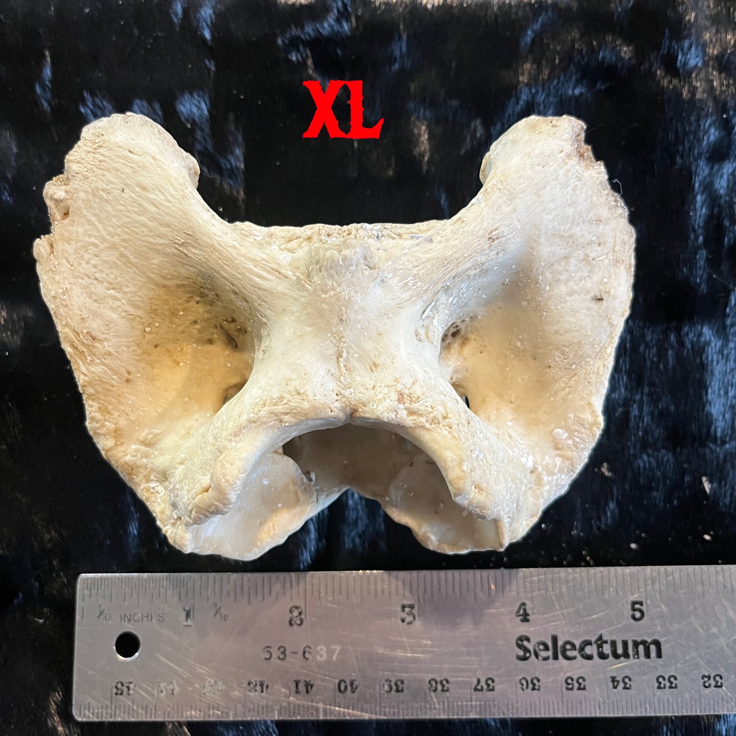 Atlas Bone