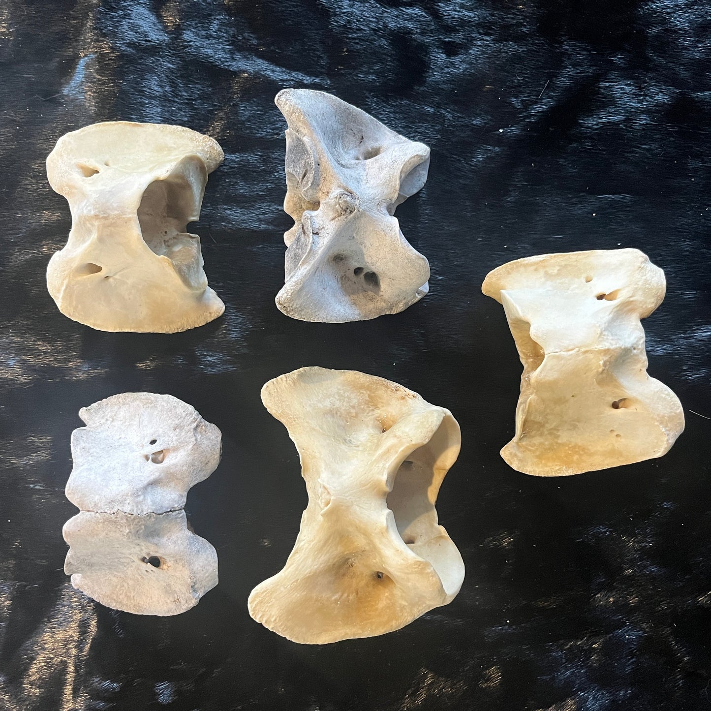 Atlas Bone