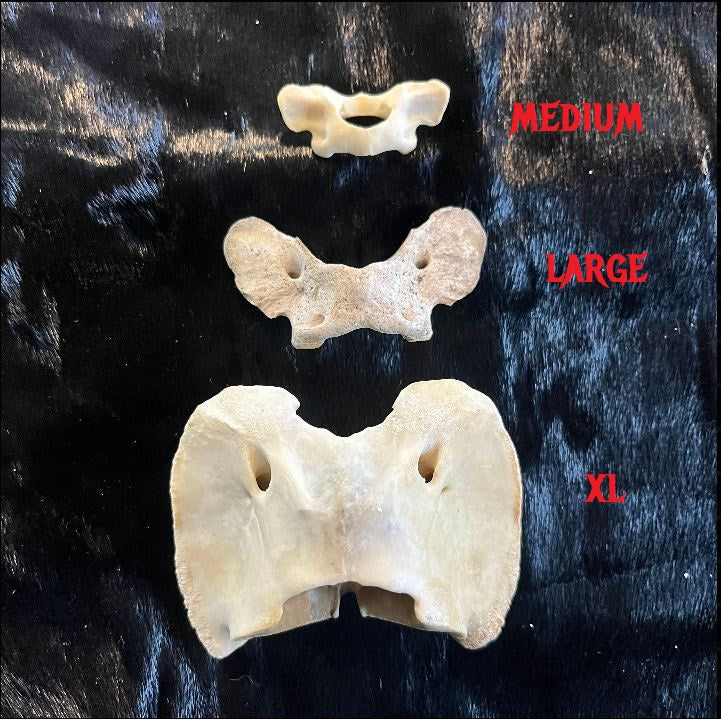 Atlas Bone