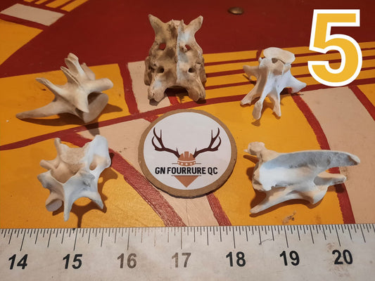 Vertebra Bone MIX