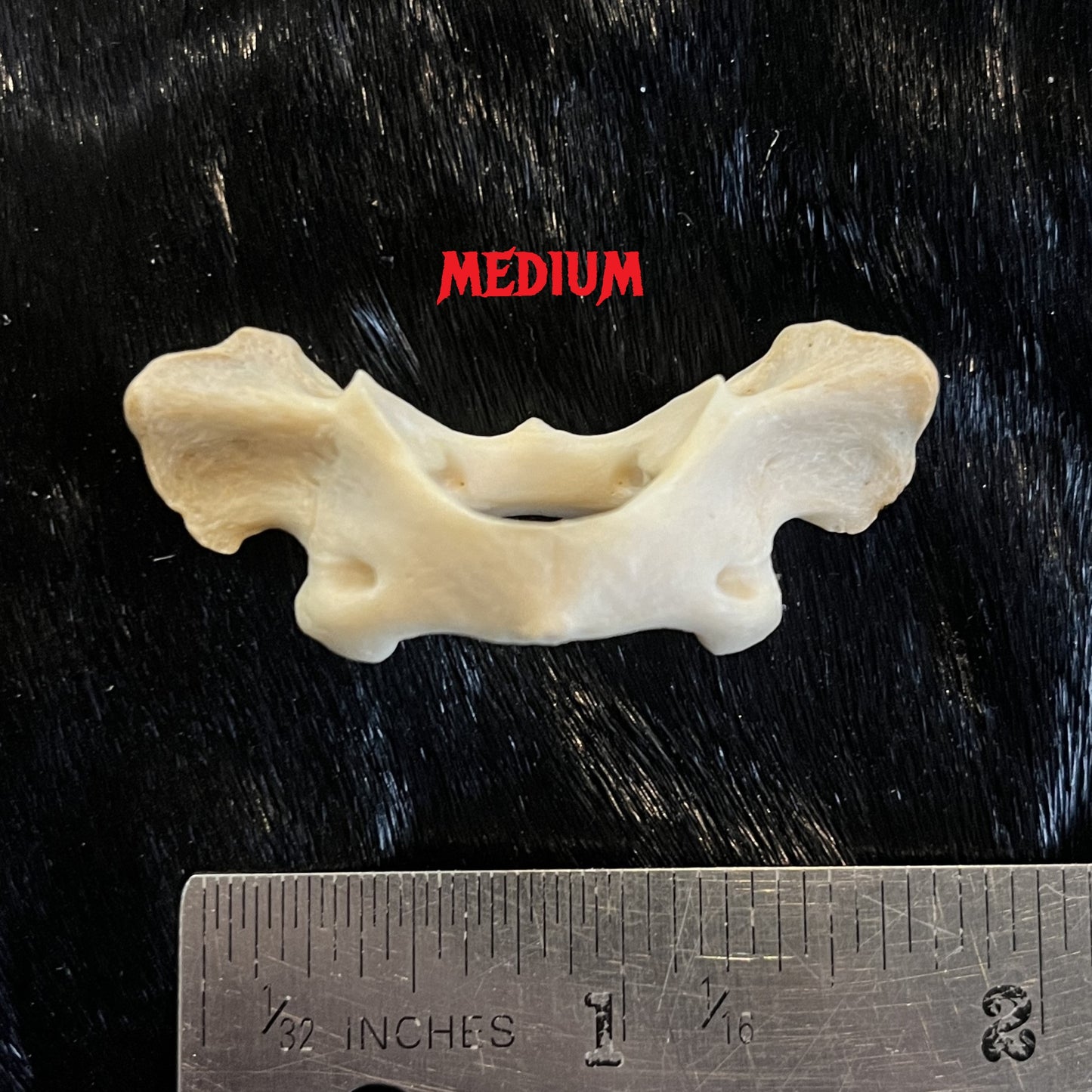 Atlas Bone