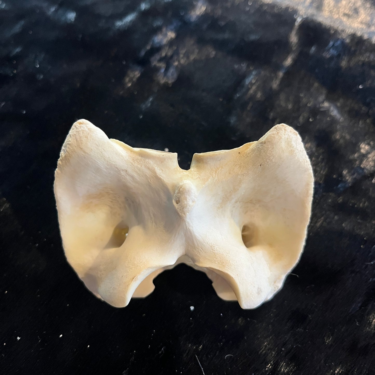 Atlas Bone