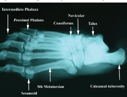 Bear Bone - Calcaneus Heel Bone